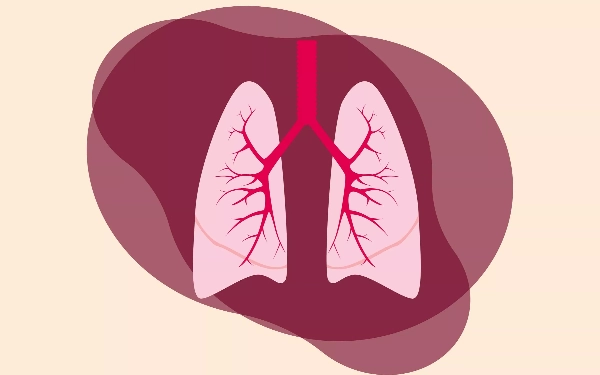 Yuk Kenali Penyebab Pneumonia dan Cara Mencegahnya